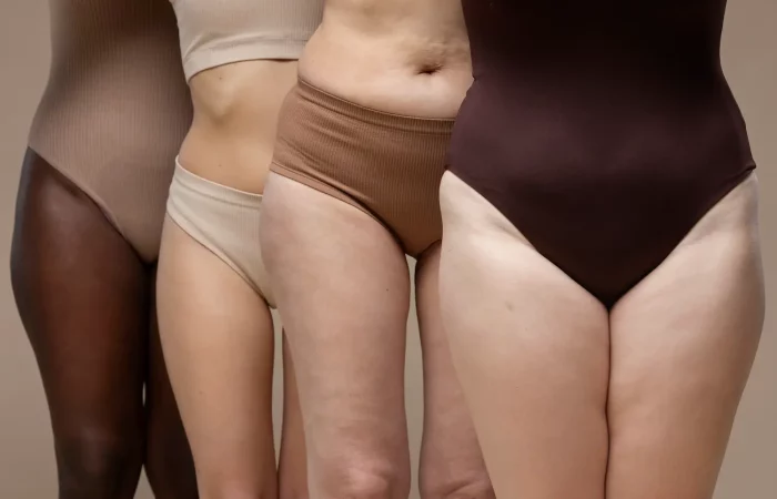 etude clinique lipoedeme
